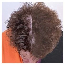 Capillus82 Laser Therapy Cap - FDA Cleared, Effective Hair Regrowth Solution -Home Electronics Store capillusultra mobile laser therapy cap for hair regrowth new 6 minute flexible fitting model 6