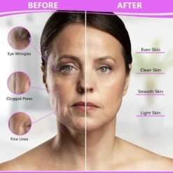 Dermal-Tech Flexible PDT LED Face Mask - Red Light Therapy For Anti-Aging, Dark Spots, And Skin Rejuvenation 12 Dermal-Tech Flexible PDT LED Face Mask - Red Light Therapy For Anti-Aging, Dark Spots, And Skin Rejuvenation -Home Electronics Store dermal tech flexible pdt led face mask red light therapy for anti aging dark spots and skin rejuvenation 4