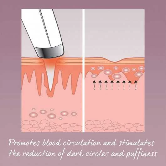 Wake Up Your Eyes: HoMedics Eye Revive Luxe For A Radiant Look 6 Wake Up Your Eyes: HoMedics Eye Revive Luxe For A Radiant Look - Image 4