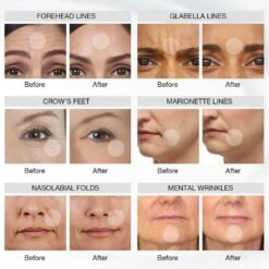 NEWKEY 7-Color LED Face Mask For Anti-Wrinkle & Acne, At-Home Light Therapy