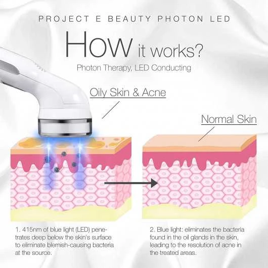 Clear Skin LED Therapy: Say Goodbye To Acne & Blemishes 5 Clear Skin LED Therapy: Say Goodbye To Acne & Blemishes - Image 3